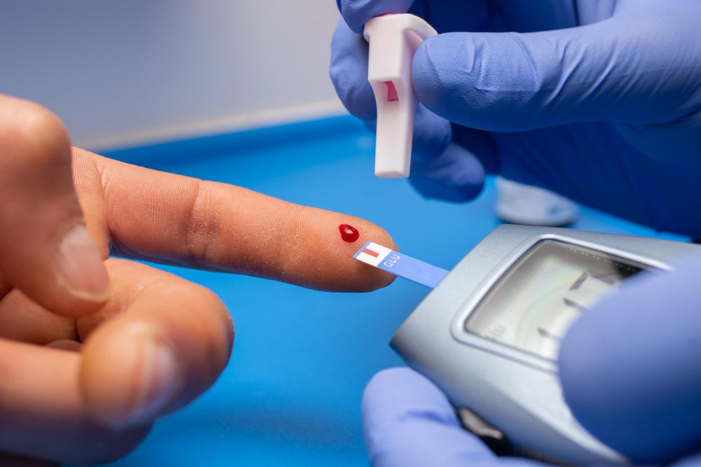 PCOS and Blood Sugar
